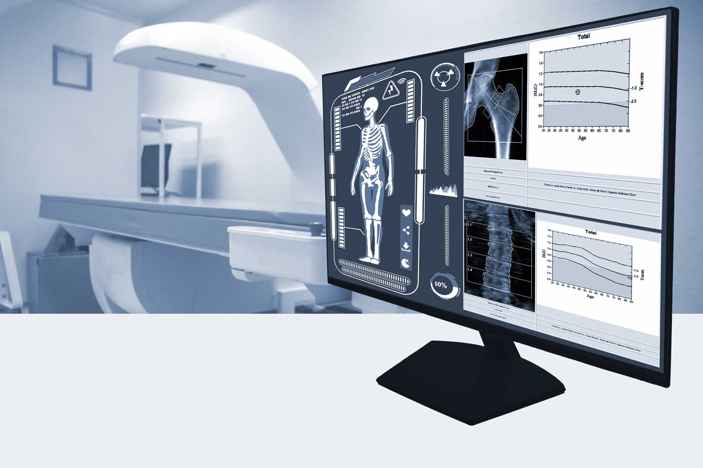 Knochendichtemessung in der Orthopädie em Veedel in Köln