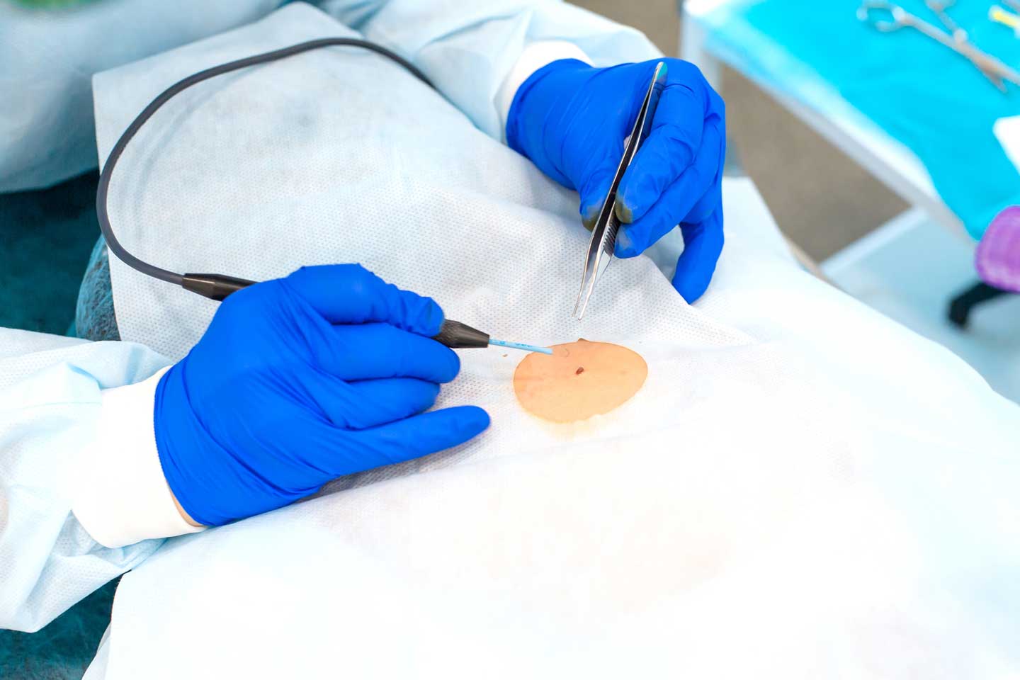 Weichteilchirurgie in der Orthopädie em Veedel in Köln